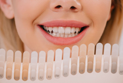 Na czym polega wybielanie zębów u dentysty?